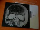 EA80 - REISE KÖLN KONZERT SPEZIAL LP SIEBDRUCK EA 80 LP