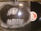 DEPOSITO DENTAL  LP  RARE  INDUSTRIAL EXPERIMENTAL