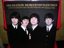 THE BEATLES SO MUCH YOUNGER THEN-5 PICTURE DISC LP SET-RARITIES-DEMOCRATIC LABEL