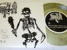 DEATH - How we die Prt 2   Hellhammer,Bathory,Venom,Sacrifice,Exorcist,Onslaught