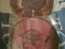 DISMEMBER - 2 MAL VINYL LP -