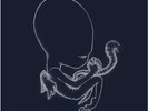Sigur Ros - Ágætis Byrjun - 2LP + print - Agaetis - Fat Cat original pressing -