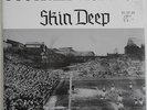 Skin Deep, 