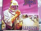 Death Leprosy