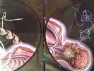 TOOL Lateralus 2LP signed autographed vinyl with Tool Army email receipt