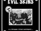 Evil Skins ?– A L'époque C'était Différent - Oi Skinhead Snix Tolbiac's Toads