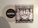 Mental: and you know this 7