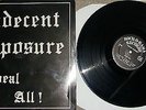 LP Indecent Exposure ?– Reveal All