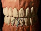 #Wolfgang Dauner Et Cetera- Knirsch MPS original TOP condition genius HEAR#