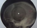 Bill HALEY Bones'n'ribs X-RAY roentgen film roentgenizdat Soviet 1950s record