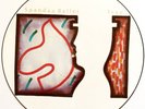 SPANDAU BALLET ?- True (LP) (Picture Disc) (EX/NM)
