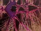 The Use Of Ashes - Firetree 2LP, Ltd, Num - Heavy Psychedelia Stoner
