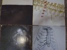 COALESCE Functioning On Impatience & Give Them Rope 2 Orig. Vinyl LPs  Hardcore