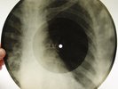 X-Ray 78rpm PETER LESHCHENKO Miranda Tango RARE USSR ROENTGEN Ribs Bones 1950s