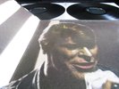 DAVID BOWIE  ???STAGE?? SELTENE HIS MASTERS VOICE ERSTPRESSUNG 