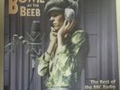 David bowie at the beeb BBC 4 record vinyl Lp box set Rare best radio 12