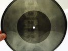 X-Ray 78rpm LESHCHENKO Glasses Stakanchiki USSR AUDIO ROENTGEN Ribs Pelvis Bones