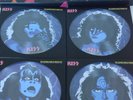 Kiss The Loudest Band in Motor City Deluxe Boxset 4x Pic Disc+72 P Book+Photos