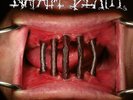 NAPALM DEATH - Coded Smears And More Uncommon Slurs DLP black NEUWARE