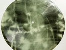 X-Ray 78rpm LESHCHENKO Blue eyes Tango RARE USSR AUDIO ROENTGEN FILM Ribs Bones