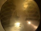X-RAY 78rpm PETR LESHCHENKO Tchorniye Glaza USSR VERY RARE AUDIO ROENTGEN Ribs