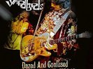 Dazed And Confused: The Yardbirds In `68 + Live At The Bbc And Beyond  VINYL NEU