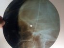 UNIQUE USSR X-RAY ROENTGEN SKULL BONES - ALRIGHT, OK YOU WIN JAZZ UNKNOWN FEMALE