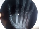 ELVIS PRESLEY - ROCK-A-HULA BABY -UNIQUE USSR GEORGIAN X-RAY ROENTGEN HAND BONES