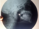 ROLLING STONES - SATISFACTION - UNIQUE USSR GEORGIAN X-RAY ROENTGEN SKULL RECORD