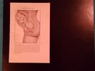 IRON LUNG SEXLESS NO SEX LP Test Pressing INFEST SIEGE CROSSED OUT SPAZZ