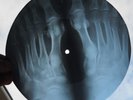 JAMES BROWN - IT'S A MAN'S WORLD - GEORGIAN USSR X-RAY ROENTGEN FOOT BONES