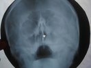 Rolling Stones - Paint It Black -  X-RAY - USSR ROENTGEN BONES Record - SKULL