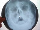 The Beatles - I Want to Hold Your Hand  UNIQUE USSR ROENTGEN BONES RECORD SKULL