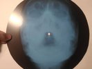Band - The Weight  X-RAY USSR ROENTGEN Bones Record skull 9