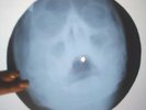 Led Zeppelin - Immigrant Song  X-RAY USSR ROENTGEN BONES RECORD