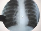 The Rolling Stones - Honky Tonk Woman  X-RAY USSR ROENTGEN BONES RECORD
