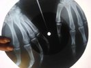 The Doors - Hello, I Love You  X-RAY USSR ROENTGEN BONES RECORD