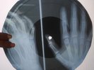 Bob Dylan - Blowin' in the Wind UNIQUE X-RAY USSR ROENTGEN Bones Record Skull