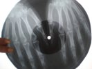 The Rolling Stones - Ruby Tuesday X-RAY USSR ROENTGEN Bones Record