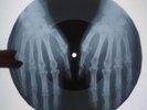 The Supremes - You Keep Me Hangin' On  X-RAY USSR ROENTGEN Bones Record