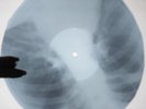 B.B.King - The Thrill Is Gone X-RAY USSR ROENTGEN Bones Record