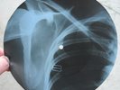 NINA SIMONE - FEELING GOOD - UNIQUE USSR GEORGIAN X-RAY ROENTGEN ARM RIBS RECORD
