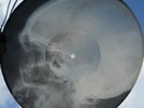 ASIAN (IRAN?) FOLK MUGHAM - USSR GEORGIAN X-RAY ROENTGEN SKULL RECORD - LISTEN