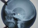 John Lennon - Woman X-RAY USSR ROENTGEN Bones Record SKULL