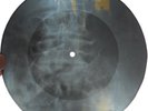 DAVID BOWIE - HAVE YOU EVER HAD A DREAM - USSR X-RAY ROENTGEN RIBS SPINE RECORD