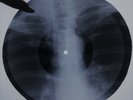 Bob Dylan - Lay, lady, lay X-RAY USSR ROENTGEN Bones Record