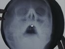 John Denver - Take Me Home, Country Roads X-RAY USSR ROENTGEN Bones Record Skull