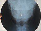 ELVIS PRESLEY - KISS ME QUICK - UNIQUE USSR GEORGIAN X-RAY ROENTGEN SKULL RECORD