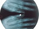 ELVIS PRESLEY - JAILHOUSE ROCK - UNIQUE USSR GEORGIAN X-RAY ROENTGEN RECORD