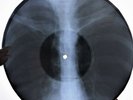 Simon and Garfunkel - The Boxer X-RAY USSR ROENTGEN Bones Record